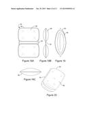 NESTABLE ANTI-LIGATIVE BED LINEN SYSTEM AND DEVICE diagram and image