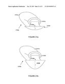 Tableware for Specialized Persons diagram and image