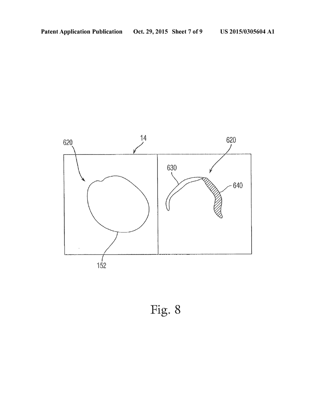 SYSTEM AND METHOD FOR VISUALIZING TISSUE WITH AN ICG DYE COMPOSITION     DURING ABLATION PROCEDURES - diagram, schematic, and image 08