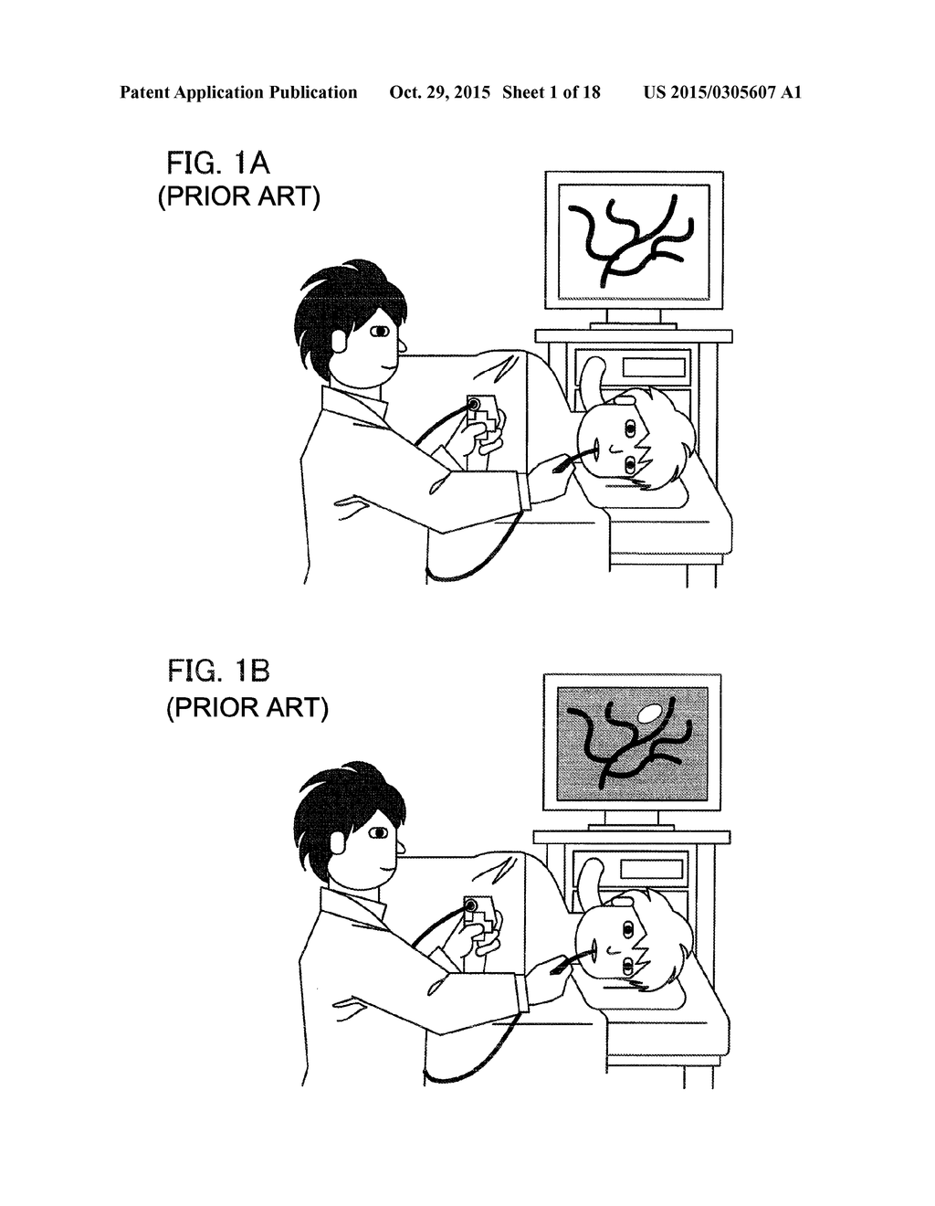 IMAGE PROCESSING DEVICE, IMAGE PROCESSING METHOD, AND PROGRAM - diagram, schematic, and image 02