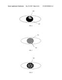 METHODS AND SYSTEMS FOR AUTOMATIC DETECTION AND CLASSIFICATION OF OCULAR     INFLAMMATION diagram and image