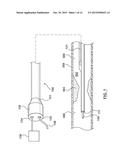 Catheter With Inner Surface Pressure Sensor for Providing a Vascular     Pressure Measurement for Determining Fractional Flow Reserve diagram and image