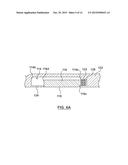 Catheter With Inner Surface Pressure Sensor for Providing a Vascular     Pressure Measurement for Determining Fractional Flow Reserve diagram and image