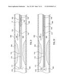 Catheter With Inner Surface Pressure Sensor for Providing a Vascular     Pressure Measurement for Determining Fractional Flow Reserve diagram and image