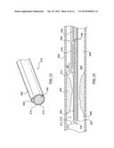 Catheter With Inner Surface Pressure Sensor for Providing a Vascular     Pressure Measurement for Determining Fractional Flow Reserve diagram and image