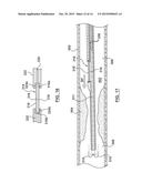 Catheter With Inner Surface Pressure Sensor for Providing a Vascular     Pressure Measurement for Determining Fractional Flow Reserve diagram and image