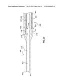 Catheter With Inner Surface Pressure Sensor for Providing a Vascular     Pressure Measurement for Determining Fractional Flow Reserve diagram and image