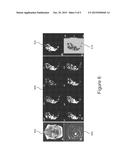 Off-Resonance Correction for Vessel-Selective Pseudo-Continuous Arterial     Spin Labeling Imaging diagram and image