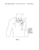 APPARATUSES AND METHODS FOR ENDOBRONCHIAL NAVIGATION TO AND CONFIRMATION     OF THE LOCATION OF A TARGET TISSUE AND PERCUTANEOUS INTERCEPTION OF THE     TARGET TISSUE diagram and image