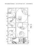 APPARATUSES AND METHODS FOR ENDOBRONCHIAL NAVIGATION TO AND CONFIRMATION     OF THE LOCATION OF A TARGET TISSUE AND PERCUTANEOUS INTERCEPTION OF THE     TARGET TISSUE diagram and image