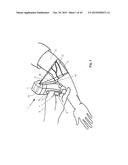 Patient-Mounted Micro Vein Enhancer diagram and image