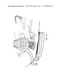 Patient-Mounted Micro Vein Enhancer diagram and image