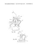 Patient-Mounted Micro Vein Enhancer diagram and image