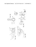 Patient-Mounted Micro Vein Enhancer diagram and image