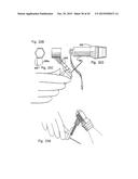 Patient-Mounted Micro Vein Enhancer diagram and image