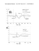 SYSTEMS AND METHODS FOR EVALUATION OF NEUROPATHOLOGIES diagram and image