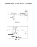 PATIENT MONITORING FOR SUB-ACUTE PATIENTS BASED ON ACTIVITY STATE AND     POSTURE diagram and image