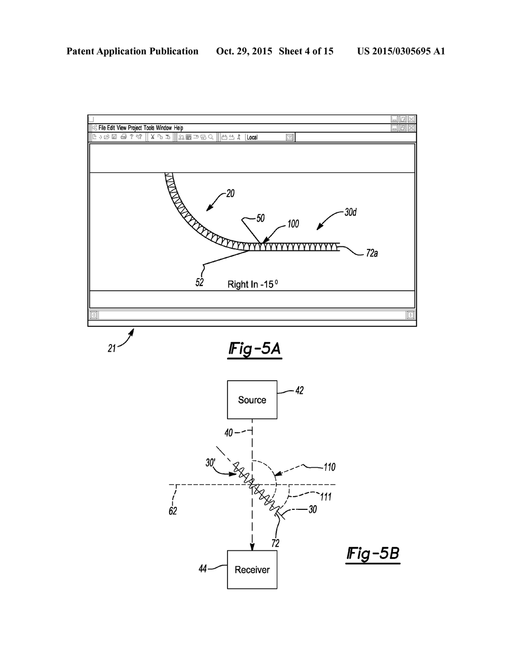 Guidance System For Localization And Cannulation Of the Coronary Sinus - diagram, schematic, and image 05