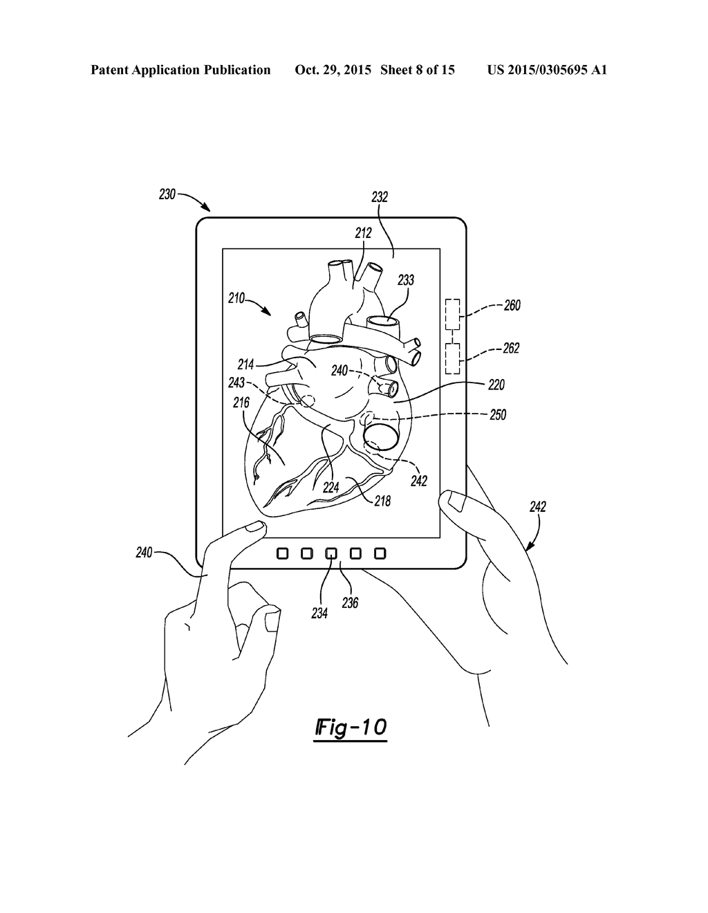 Guidance System For Localization And Cannulation Of the Coronary Sinus - diagram, schematic, and image 09