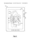 Guidance System For Localization And Cannulation Of the Coronary Sinus diagram and image