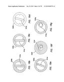 WOUND RETRACTOR WITH SPLIT HOOPS diagram and image