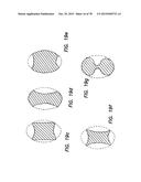 WOUND RETRACTOR WITH SPLIT HOOPS diagram and image