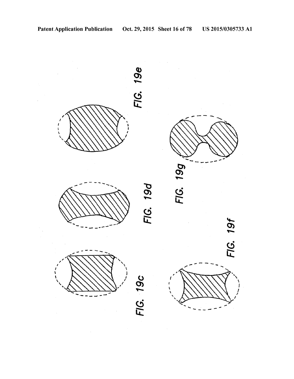 WOUND RETRACTOR WITH SPLIT HOOPS - diagram, schematic, and image 17