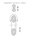 WOUND RETRACTOR WITH SPLIT HOOPS diagram and image