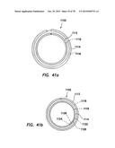 WOUND RETRACTOR WITH SPLIT HOOPS diagram and image