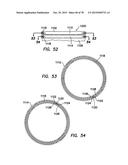 WOUND RETRACTOR WITH SPLIT HOOPS diagram and image