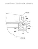 WOUND RETRACTOR WITH SPLIT HOOPS diagram and image