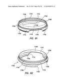 WOUND RETRACTOR WITH SPLIT HOOPS diagram and image