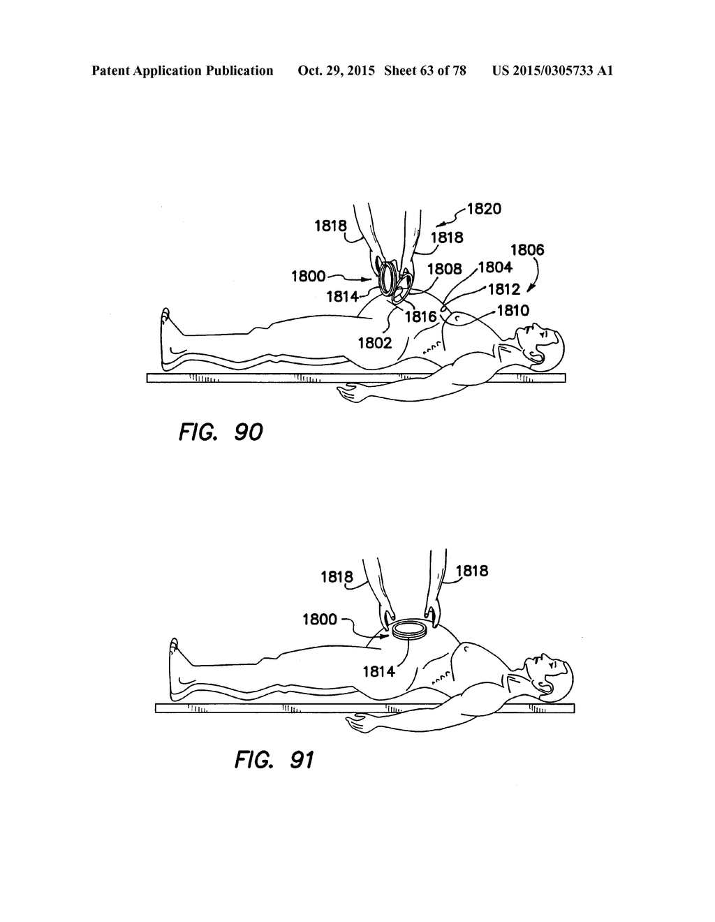 WOUND RETRACTOR WITH SPLIT HOOPS - diagram, schematic, and image 64