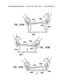 WOUND RETRACTOR WITH SPLIT HOOPS diagram and image