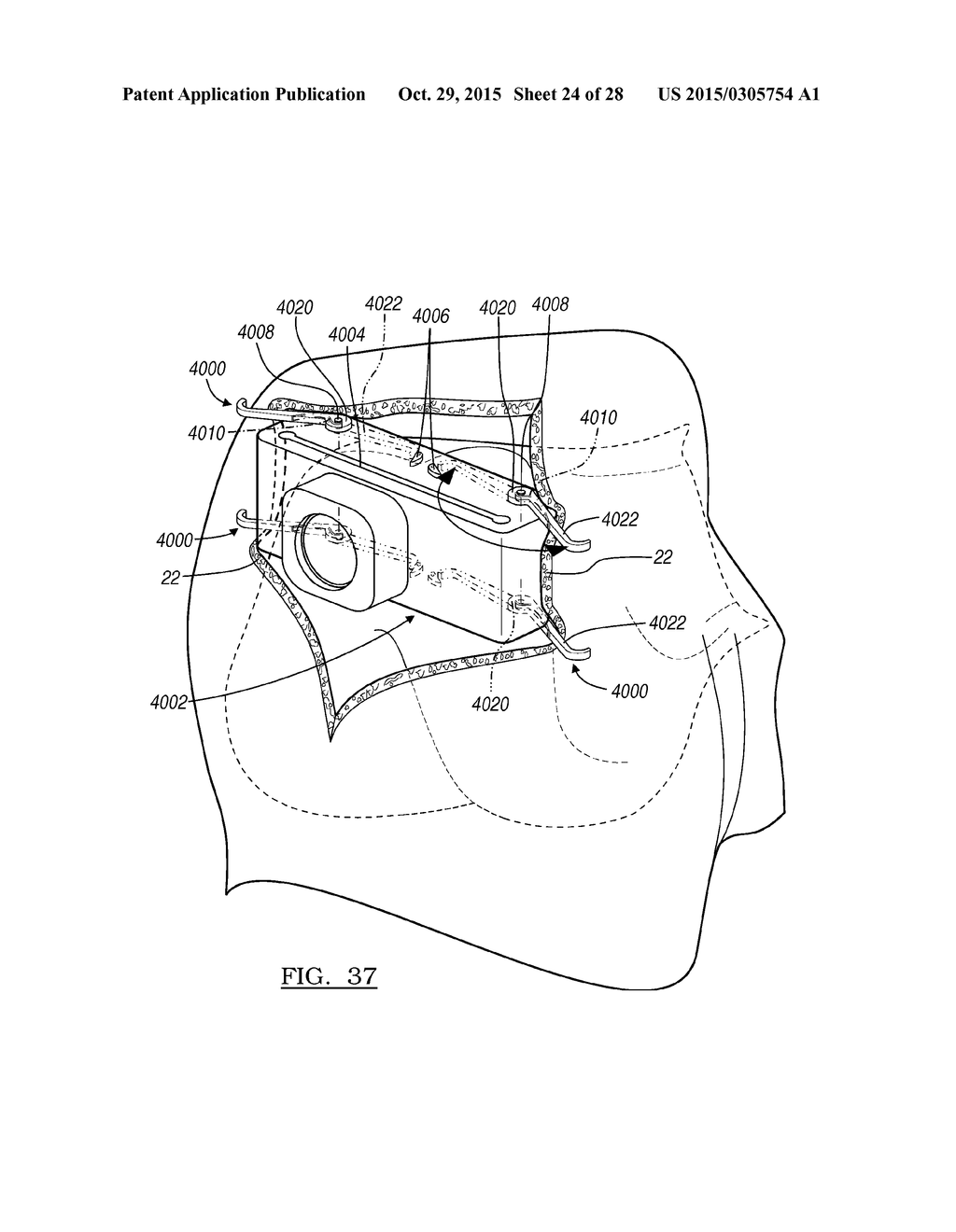 Instrumentation For Knee Resection - diagram, schematic, and image 25