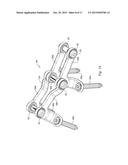 SPINAL STABILIZATION SYSTEM AND METHOD diagram and image