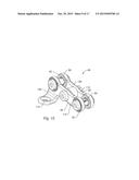 SPINAL STABILIZATION SYSTEM AND METHOD diagram and image