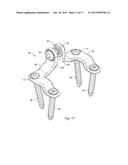 SPINAL STABILIZATION SYSTEM AND METHOD diagram and image