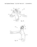 SPINAL STABILIZATION SYSTEM AND METHOD diagram and image