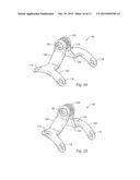 SPINAL STABILIZATION SYSTEM AND METHOD diagram and image