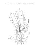 BONE FIXATION ASSEMBLY diagram and image