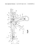 BONE FIXATION ASSEMBLY diagram and image