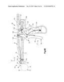 BONE FIXATION ASSEMBLY diagram and image