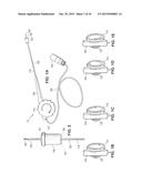 DEVICES AND METHODS FOR RADIOFREQUENCY ABLATION HAVING AT LEAST TWO     ELECTRODES diagram and image