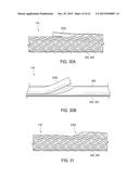 Neuromodulation Catheters Having Braided Shafts and Associated Systems and     Methods diagram and image