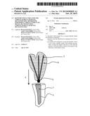 REINFORCEMENT STRUCTURE FOR CORONAL-RADICULAR DENTAL RECONSTITUTION,     METHOD FOR PERFORMING CORONAL-RADICULAR DENTAL RECONSTITUTION,     CORONAL-RADICULAR DENTAL RECONSTITUTION diagram and image