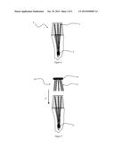 REINFORCEMENT STRUCTURE FOR CORONAL-RADICULAR DENTAL RECONSTITUTION,     METHOD FOR PERFORMING CORONAL-RADICULAR DENTAL RECONSTITUTION,     CORONAL-RADICULAR DENTAL RECONSTITUTION diagram and image