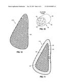 LIGHTER WEIGHT IMPLANT diagram and image