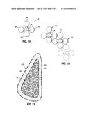 LIGHTER WEIGHT IMPLANT diagram and image