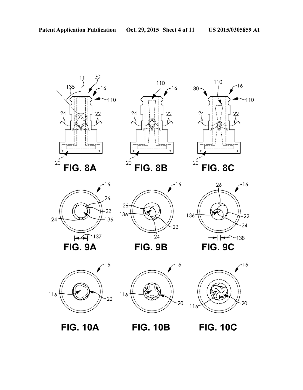 Selective Fluid Barrier Valve Device and Method of Treatment - diagram, schematic, and image 05